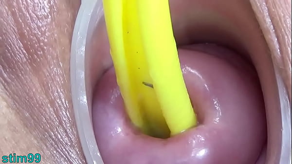 Cervix and Pee Hole Inflation with Injections for Japanese Lesbians